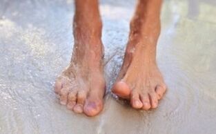 walk barefoot as the cause of the fungus