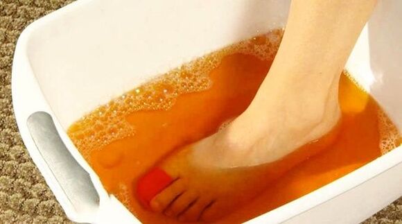 iodine bath against athlete's foot