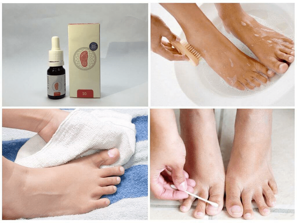 Different drugs for foot fungus
