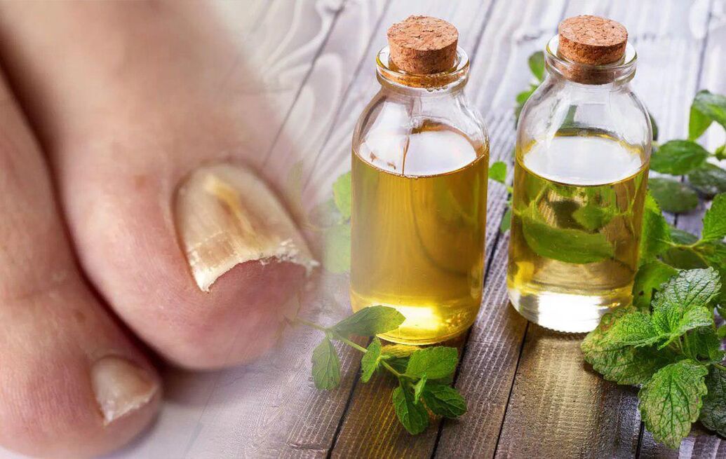 vinegar the nail fungus