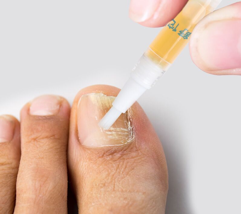 against liquid nail fungus
